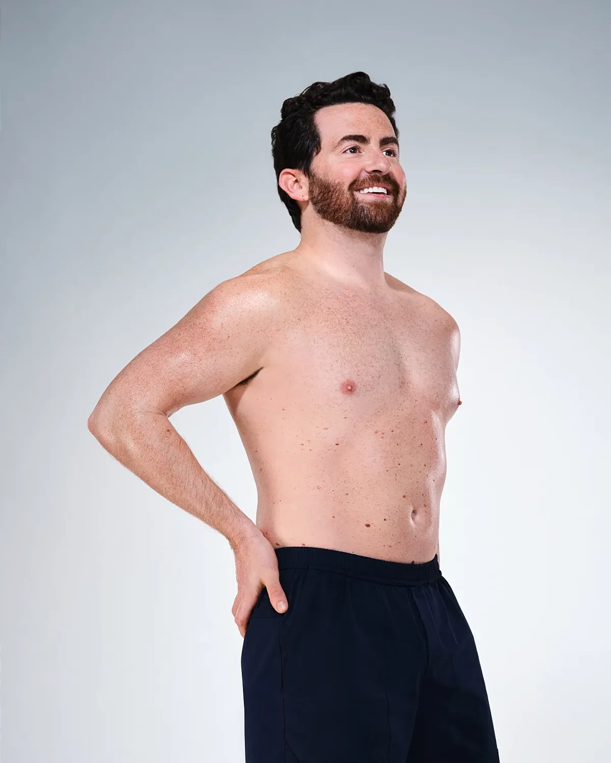 Coolsculpting Before & After