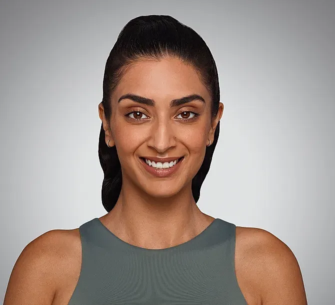 Juvederm Before & After