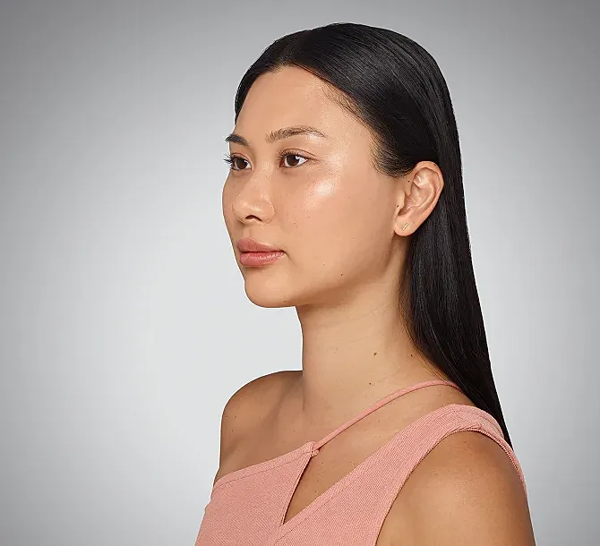 Juvederm Before & After