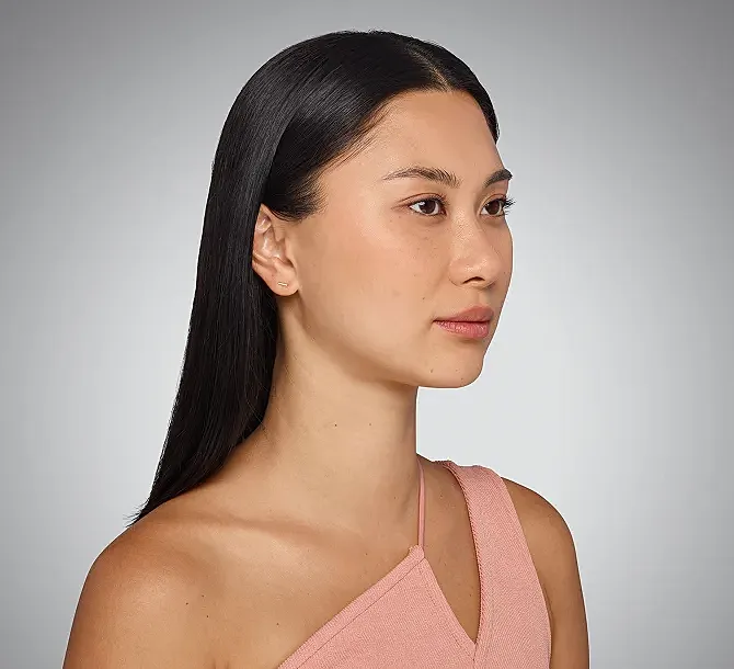 Juvederm Before & After