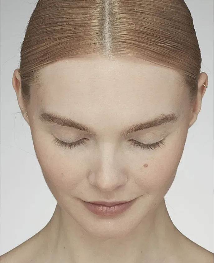 Latisse Before & After